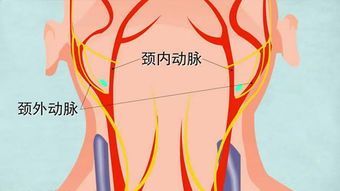 颈动脉彩超检查什么？颈动脉彩超多少钱？(图1)